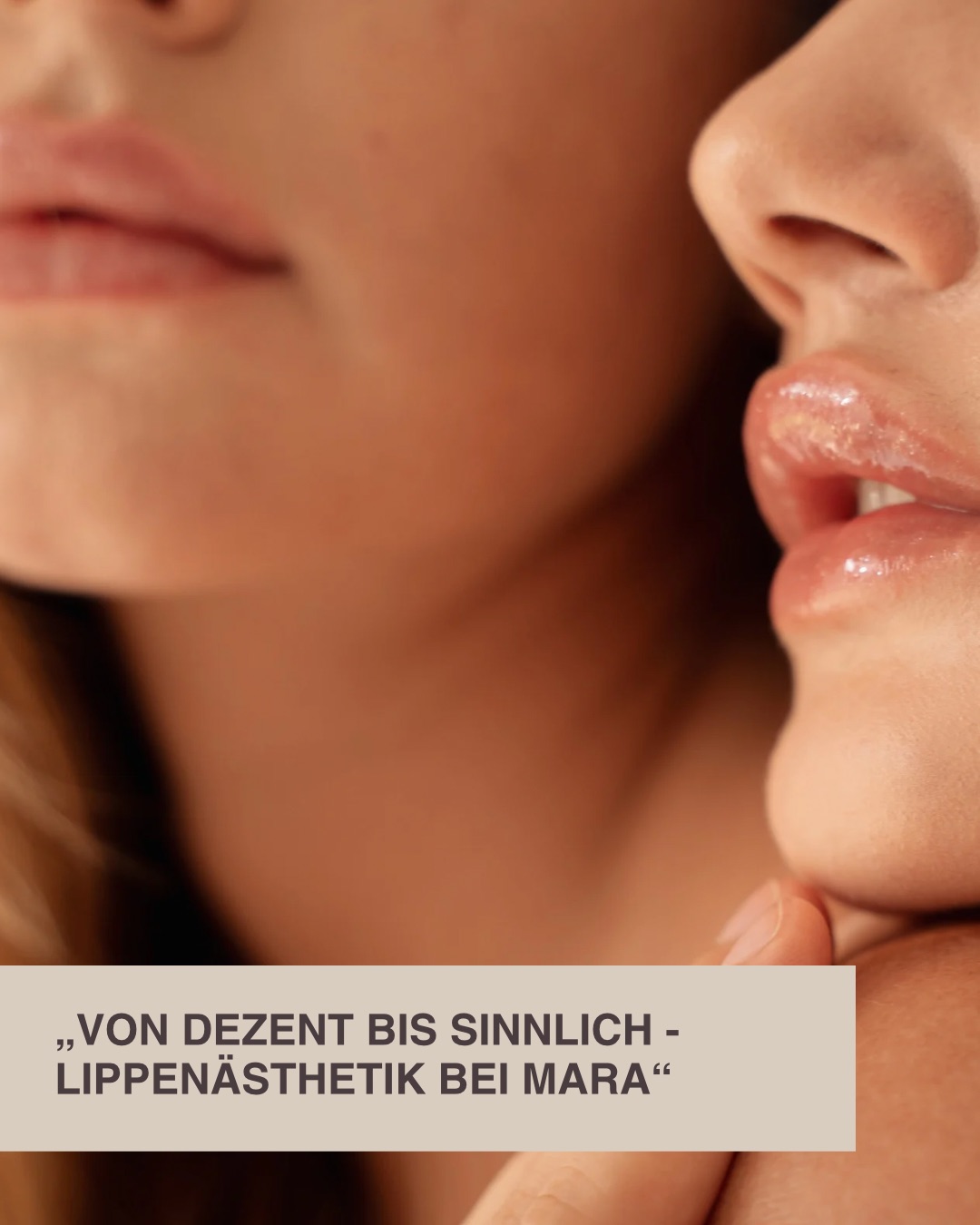 Von Dezent bis Sinnlich - Lippenästhetik bei Mara